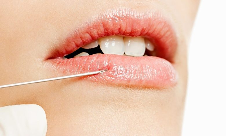 آیا تزریق فیلرهای پوستی خطر عفونت به‌همراه دارد