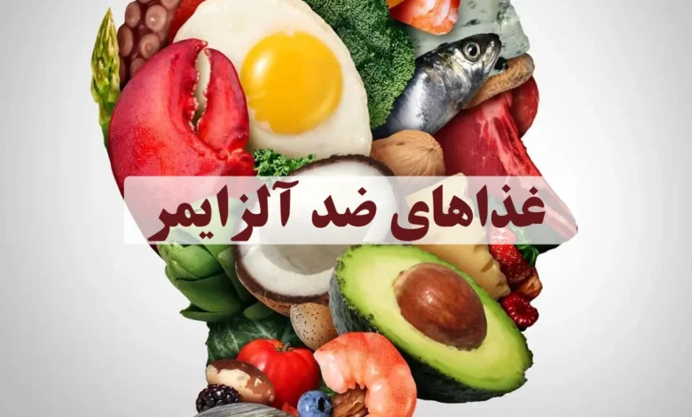 غذاهای ضد آلزایمر