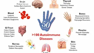 بیماری خودایمنی چیست؟