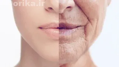 چگونه از از افتادگی و چروک صورت جلوگیری کنیم؟