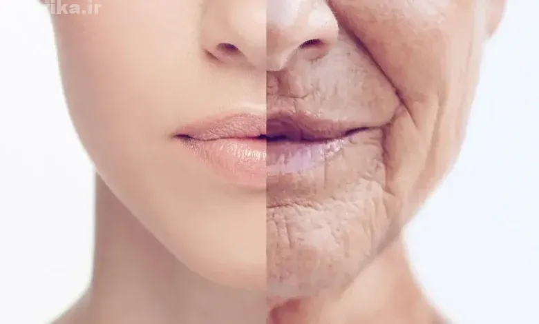 چگونه از از افتادگی و چروک صورت جلوگیری کنیم؟