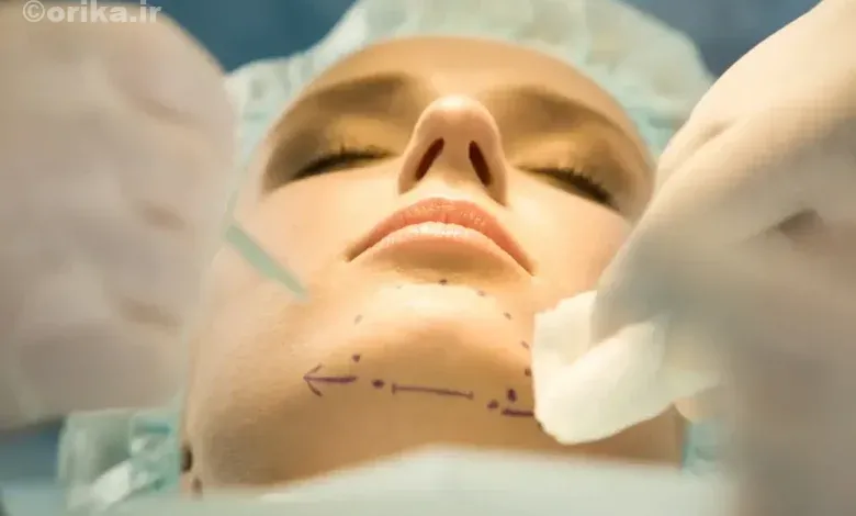 جراحی زیبایی فک و چانه