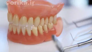 محلات قطب ساخت دندان مصنوعی ایران