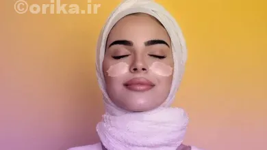 پروتز گونه دائمی