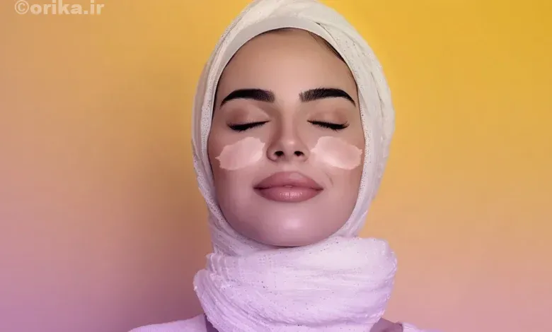 پروتز گونه دائمی