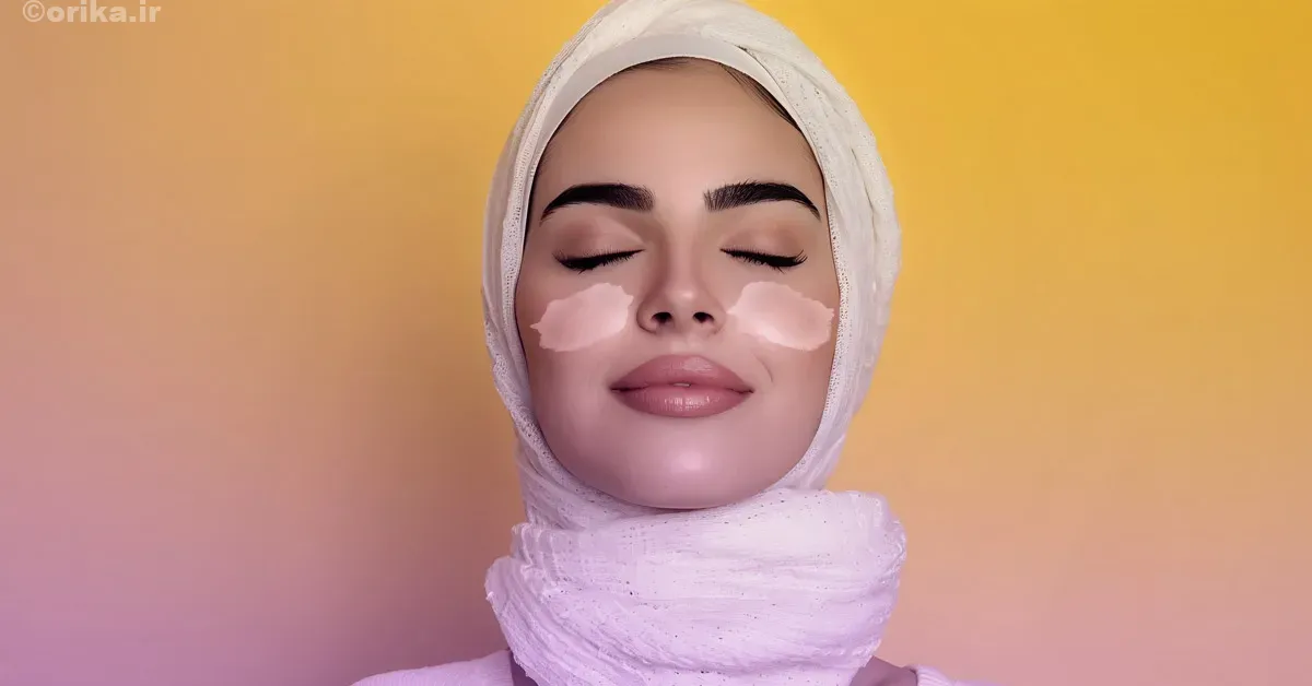 پروتز گونه دائمی