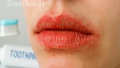 حساسیت لب به خمیردندان