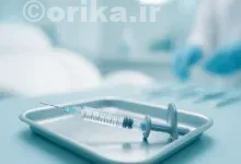 مدت زمان ماندگاری تزریق ژل