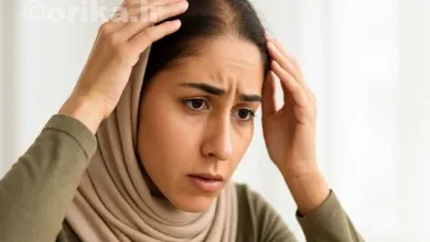 ریزش مو در زنان