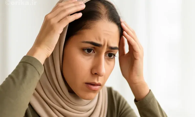 ریزش مو در زنان