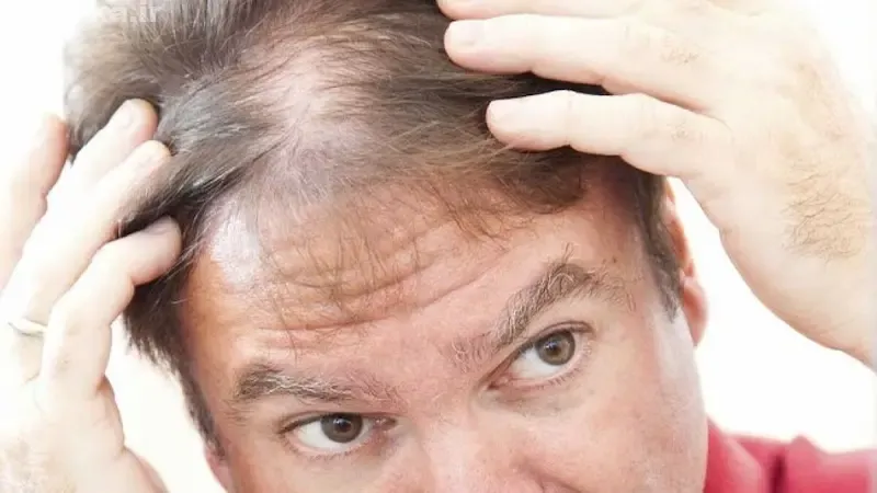 PP405 چیست و چرا خاص است؟