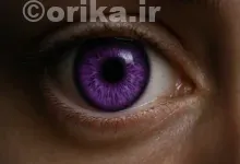 سندرم الژاندریا