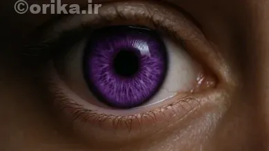 سندرم الژاندریا
