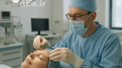 تکنولوژی‌های جدید در لیفت شقیقه