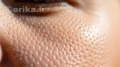 شگفتی‌های پوست