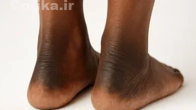 موثرترین و کاربردی ترین روش های رفع تیرگی و سیاهی قوزک پا