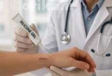 برای ترمیم رد بخیه در چه زمانی و از چه پمادی استفاده کنیم؟