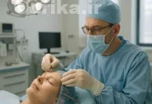 تکنولوژی‌های جدید در لیفت شقیقه