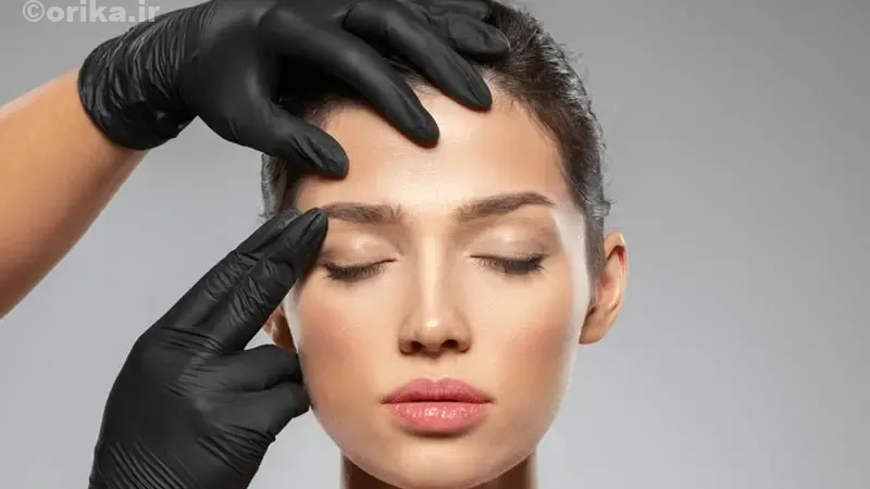 عوارض احتمالی لیفت شقیقه