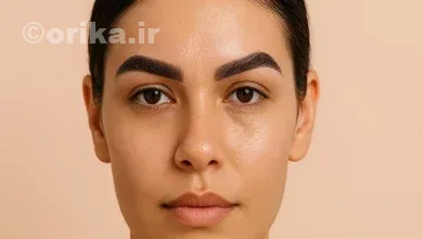 فیبروز ابرو پوست چرب