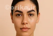 فیبروز ابرو پوست چرب