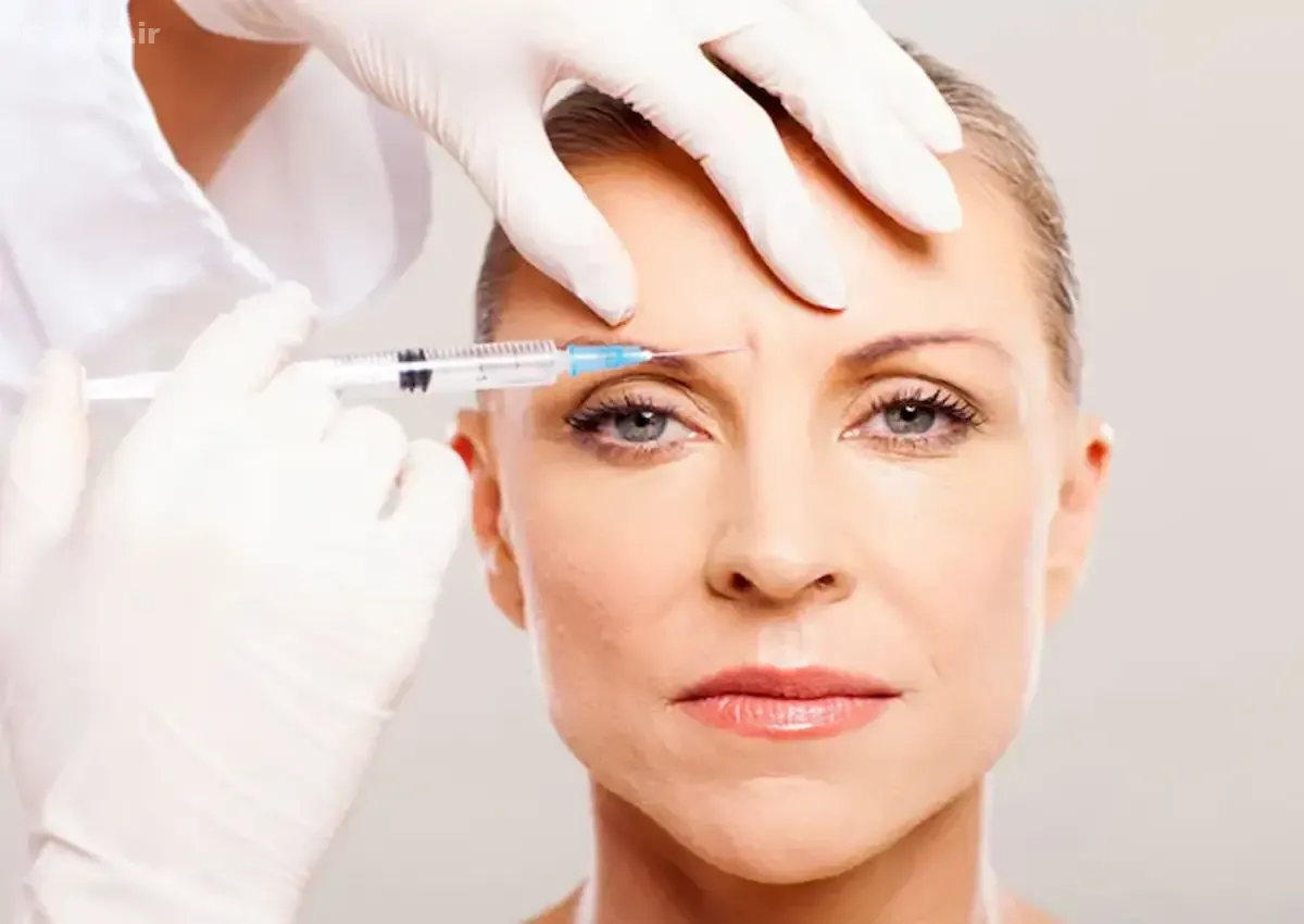 بوتاکس بعد از چند روز خودشو نشون میده؟