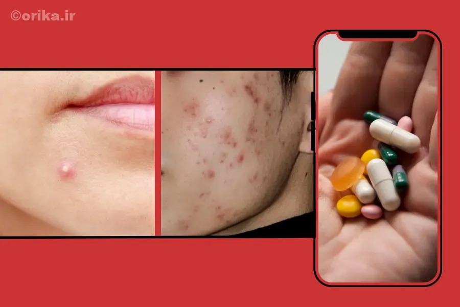 نحوه عملکرد قرص راکوتان