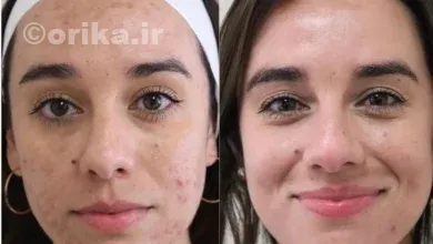 قرص راکوتان