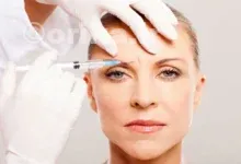 بوتاکس بعد از چند روز خودشو نشون میده؟