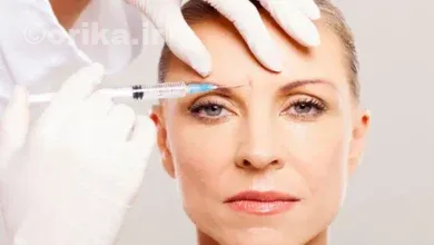 بوتاکس بعد از چند روز خودشو نشون میده؟