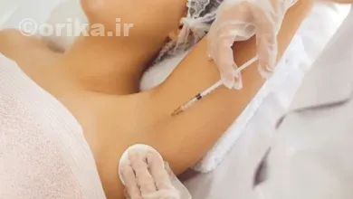 بوتاکس زیر بغل چه عوارضی داره؟