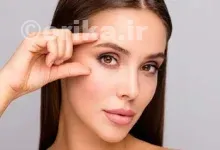 بوتاکس چشم گربه‌ای چند روز بعد اثر می‌کند؟