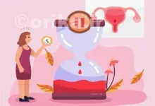 چگونه از یائسگی زودرس جلوگیری کنیم؟