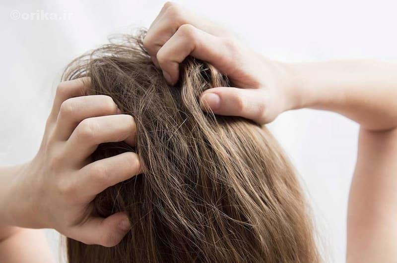ارتباط خارش سر با ریزش مو