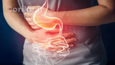 بیماری جدید گوارشی چیست؟ علائم و درمان