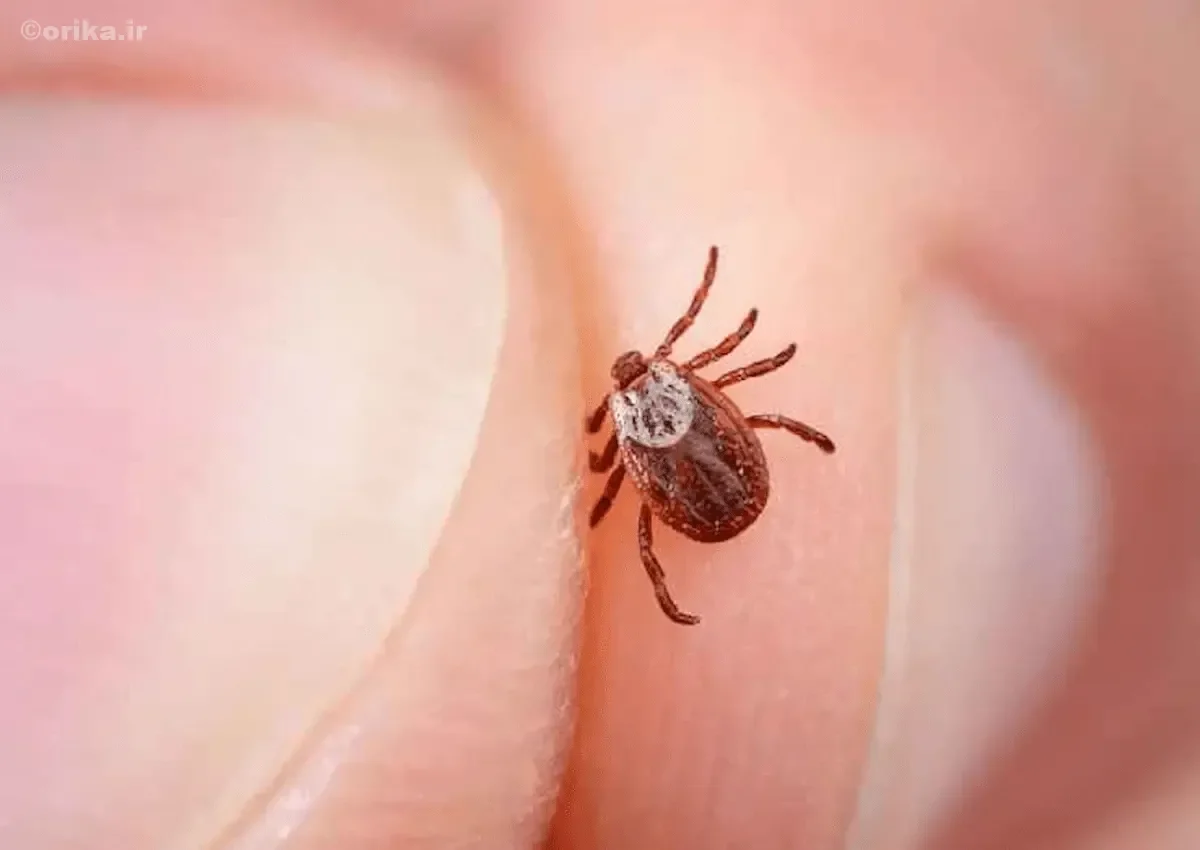 بیماری لایم چیست؟ علائم، تشخیص و درمان مرحله‌به‌مرحله