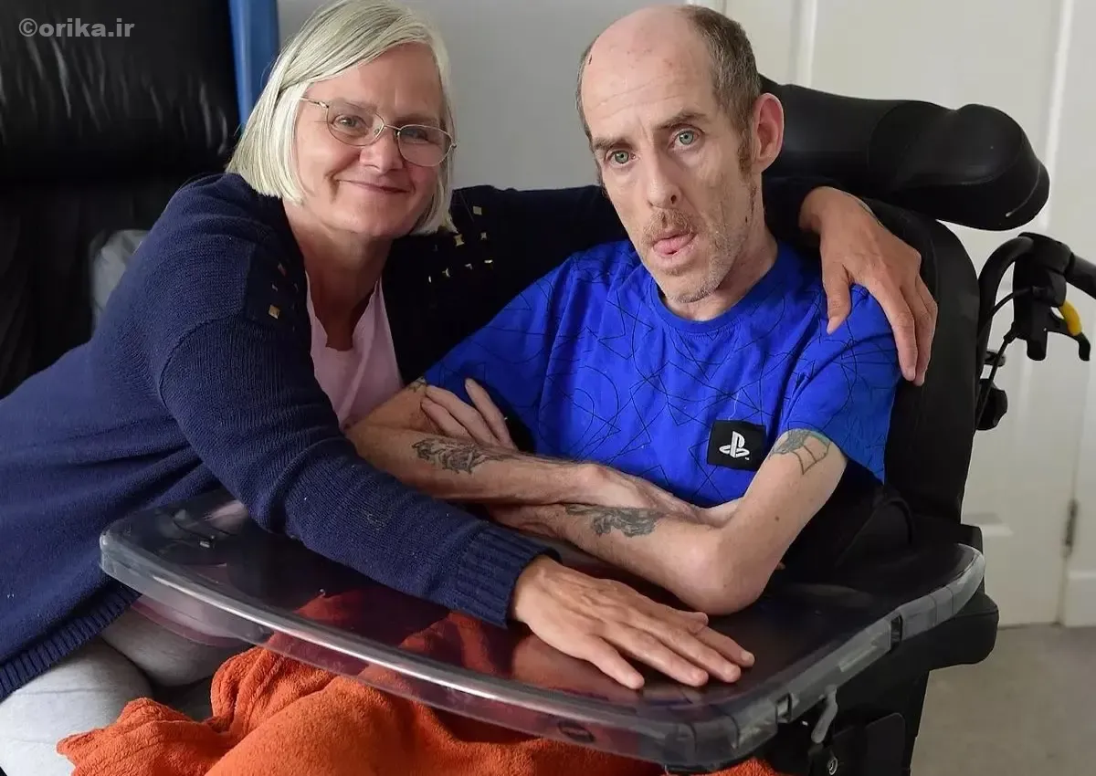  بیماری هانتینگتون