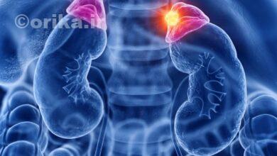 بیماری کورتیزول