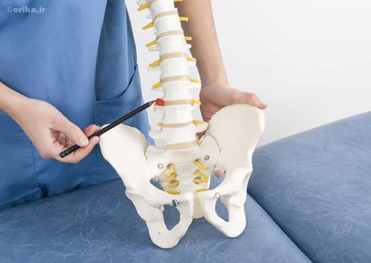 درد دنبالچه لگن