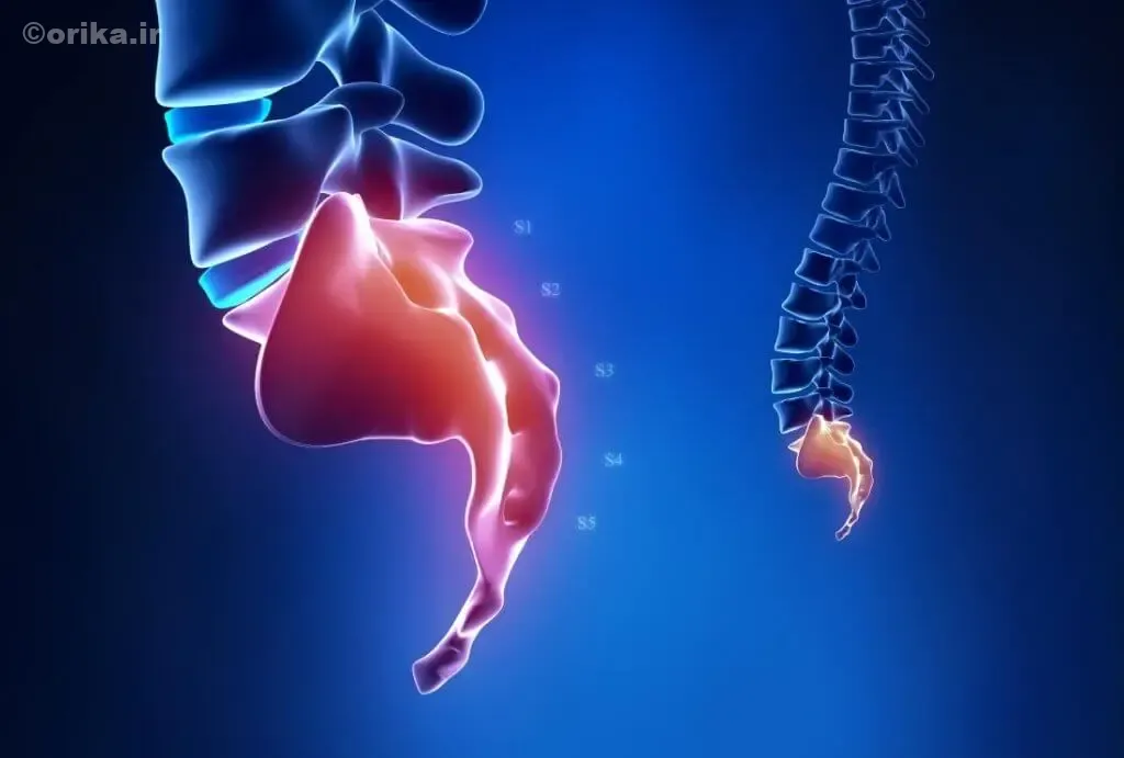 درد دنبالچه لگن