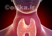 جراحی تیروئید