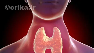 جراحی تیروئید