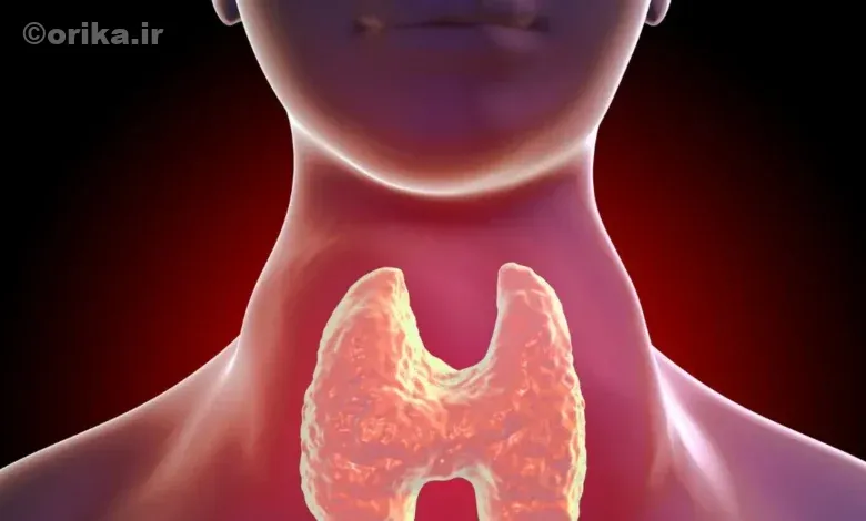 جراحی تیروئید