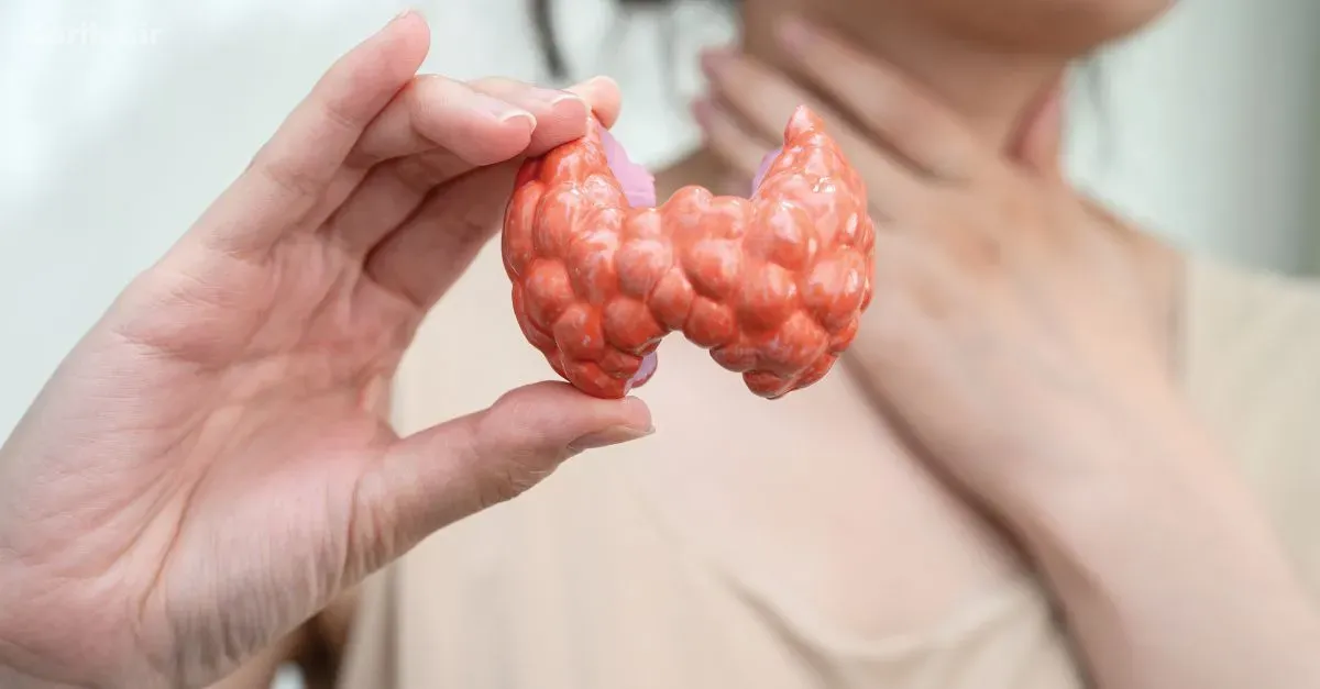 تیروئید در تهران