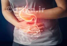 بیماری جدید گوارشی چیست؟ علائم و درمان