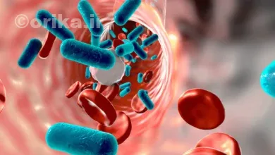 بیماری سپسیس چیست؟