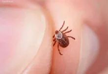 بیماری لایم چیست؟ علائم، تشخیص و درمان مرحله‌به‌مرحله