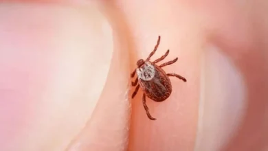 بیماری لایم چیست؟ علائم، تشخیص و درمان مرحله‌به‌مرحله