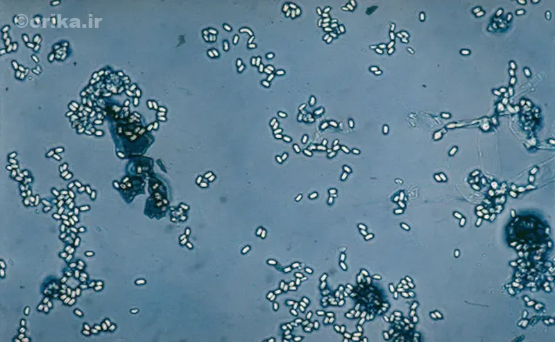 بیماری نوزما زنبور عسل چیست؟