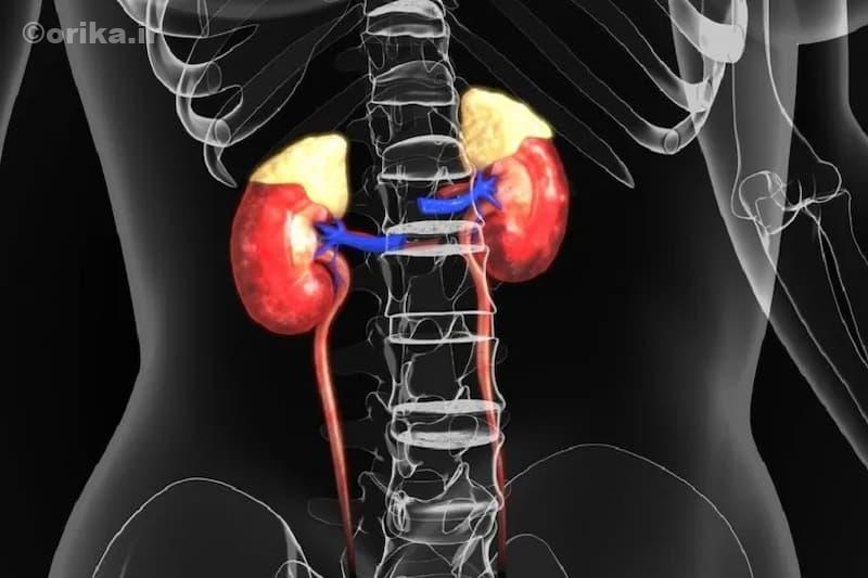 تفاوت بیماری و سندروم کوشینگ